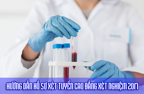 Tuyển sinh Cao đẳng Xét nghiệm 2017 Tuyển sinh Cao đẳng Xét nghiệm 2017