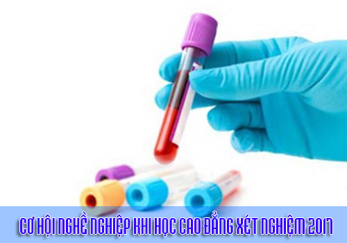 Cơ hội nghề nghiệp khi học Cao đẳng Xét nghiệm 2017 Cơ hội nghề nghiệp khi học Cao đẳng Xét nghiệm 2017